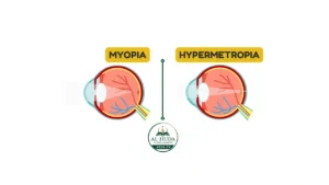 Difference Between Short-Sightedness (Myopia) and Long-Sightedness (Hypermetropia)